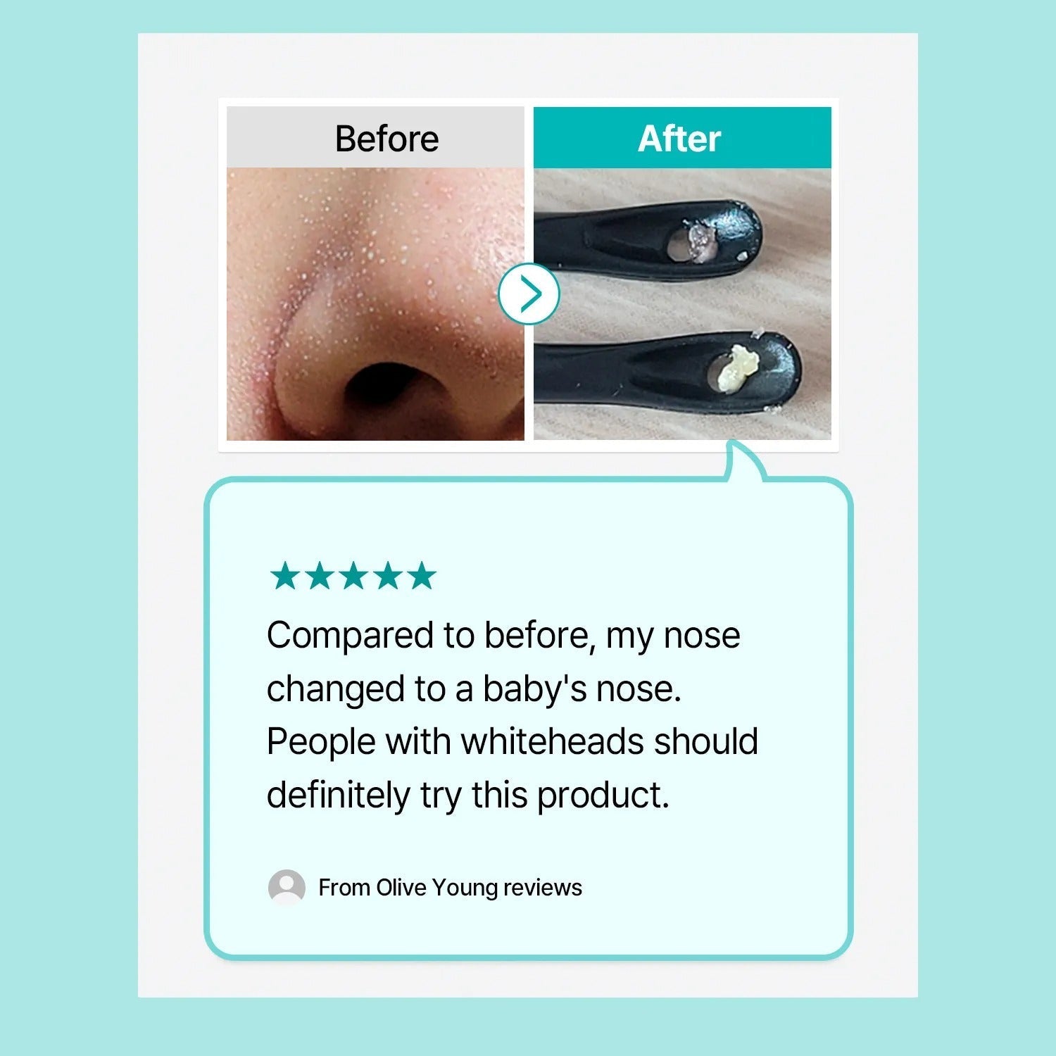 ilso Natural Mild Clear Nose Patch 5ea
