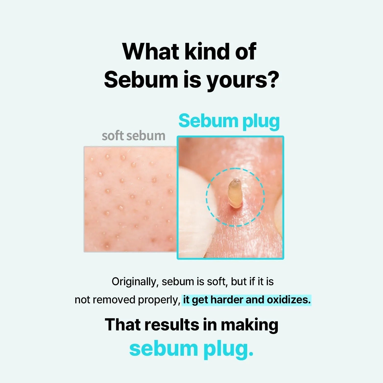 ilso Super Melting Sebum Softener 150mL